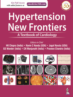 Hypertension de Hk Chopra
