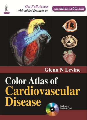 Color Atlas of Cardiovascular Disease de Glenn N Levine