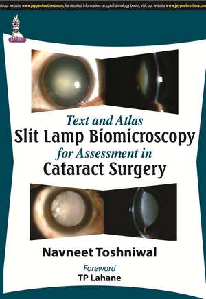 Text and Atlas: Slit Lamp Biomicroscopy for Assessment in Cataract Surgery de Navneet Toshniwal