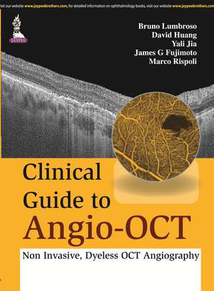 Clinical Guide to Angio-OCT: Non Invasive, Dyeless OCT Angiography de Bruno Lumbroso