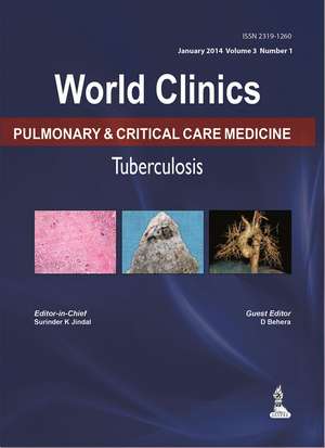 World Clinics: Pulmonary & Critical Care Medicine - Tuberculosis, Volume 3, No: 1 de Surinder K Jindal