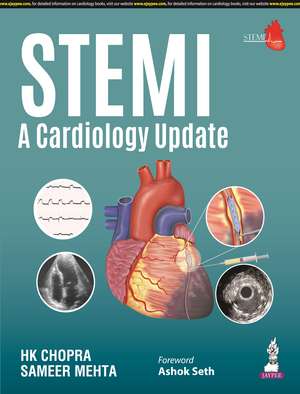 STEMI: A Cardiology Update de HK Chopra