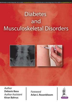 Diabetes and Musculoskeletal Disorders de Debasis Basu