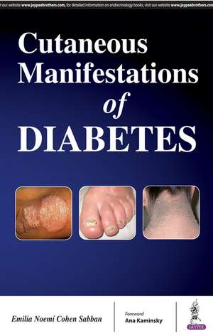 Cutaneous Manifestations of Diabetes de Emilia Noemie Cohen Sabban