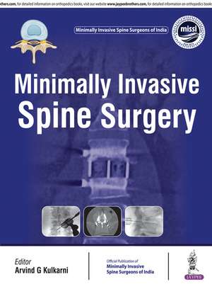 Minimally Invasive Spine Surgery de Arvind Kulkarni