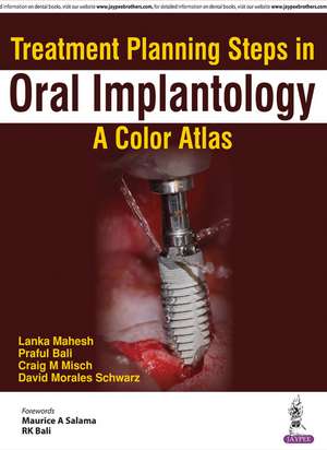 Treatment Planning Steps in Oral Implantology: A Color Atlas de Lanka Mahesh