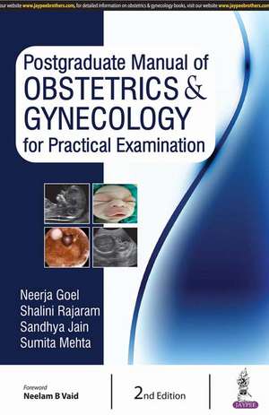 Postgraduate Manual of Obstetrics & Gynecology for Practical Examination de Neerja Goel