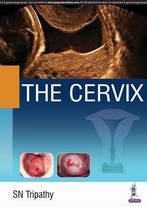 The Cervix de SN Tripathy