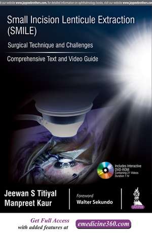 Small Incision Lenticule Extraction (SMILE): Surgical Technique and Challenges: Comprehensive Text and Video Guide de Jeewan S Titiyal