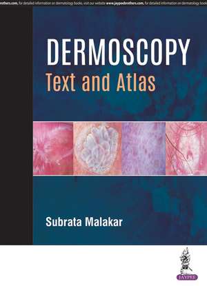 Dermoscopy: Text and Atlas de Subrata Malakar