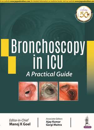 Bronchoscopy in ICU: A Practical Guide de Manoj K Goel