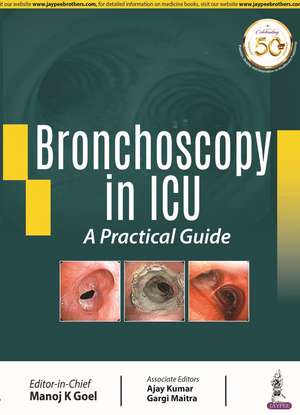 Bronchoscopy in ICU de Manoj K Goel