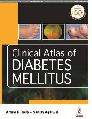 Clinical Atlas of Diabetes Mellitus de Arturo R Rolla