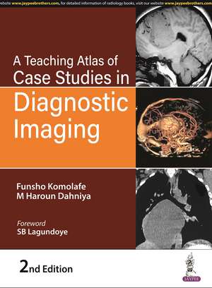 A Teaching Atlas of Case Studies in Diagnostic Imaging de Funsho Komolafe