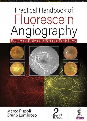 Practical Handbook of Fluorescein Angiography: Posterior Pole and Retinal Periphery de Marco Rispoli