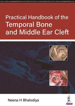 Practical Handbook of the Temporal Bone and Middle Ear Cleft de Neena H Bhalodiya