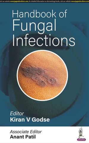 Handbook of Fungal Infections de Kiran V Godse