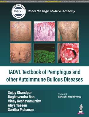 Textbook of Pemphigus and other Autoimmune Bullous Diseases de Sujay Khandpur