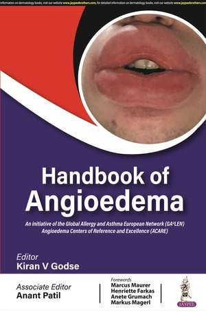 Handbook of Angioedema de Kiran V Godse