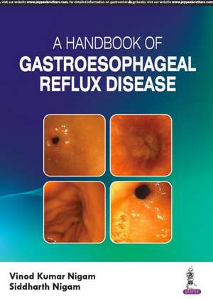 A Handbook of Gastroesophageal Reflux Disease (GERD) de Vinod Kumar Nigam