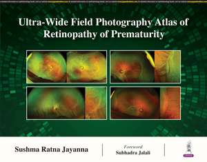 Ultra-Wide Field Photography Atlas of Retinopathy of Prematurity de Sushma Ratna Jayanna