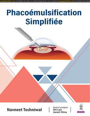 Phacoémulsification Simplifiée: French Edition de Navneet Toshniwal