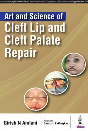 Art and Science of Cleft Lip and Cleft Palate Repair de Girish N Amlani