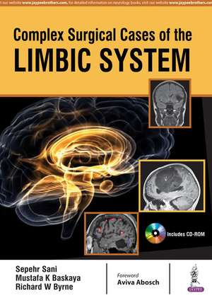 Complex Surgical Cases of the Limbic System de Sepehr Sani