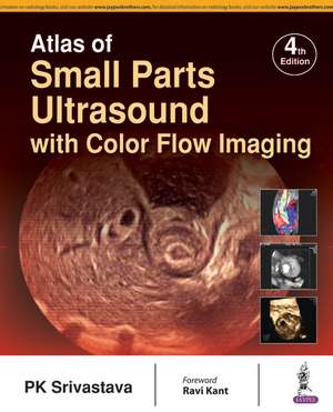 Atlas of Small Parts Ultrasound: with Color Flow Imaging de P. K. Srivastava