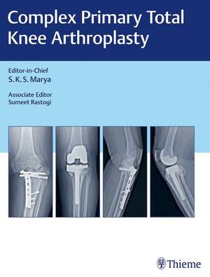 Complex Primary Total Knee Arthroplasty de S.K.S. Marya