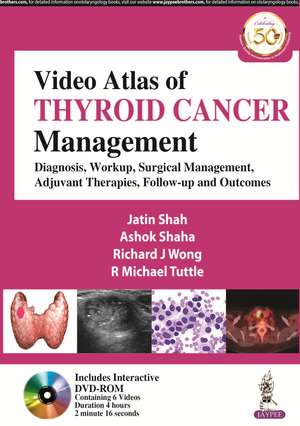 Video Atlas of Thyroid Cancer Management: Diagnosis, Workup, Surgical Management, Adjuvant Therapies, Follow-up and Outcomes de Jatin Shah