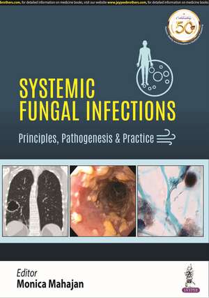 Systemic Fungal Infections: Principles, Pathogenesis & Practice de Monica Mahajan