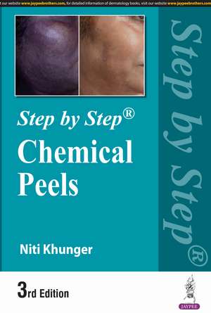 Step by Step: Chemical Peels de Niti Khunger