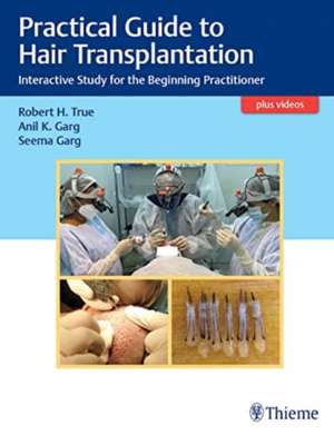 Practical Guide to Hair Transplantation – Interactive Study for the Beginning Practitioner de Robert H True