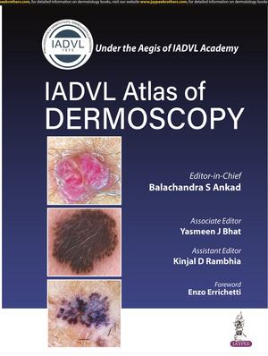 Atlas of Dermoscopy de Balachandra S Ankad