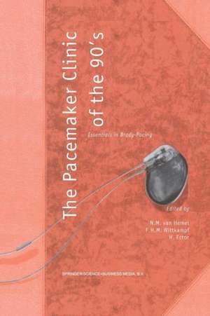 The Pacemaker Clinic of the 90’s: Essentials in Brady-Pacing de N.M. van Hemel