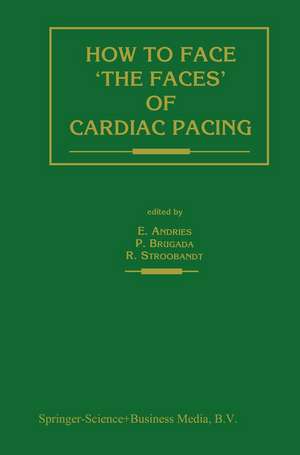 How to face ‘the faces’ of CARDIAC PACING de Erik Andries