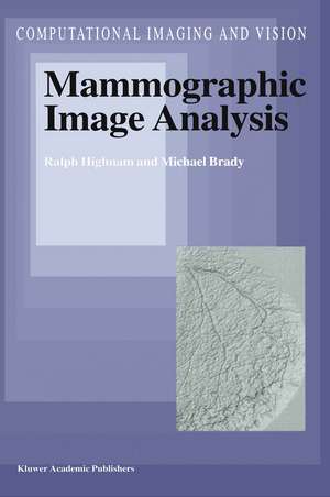 Mammographic Image Analysis de R. Highnam