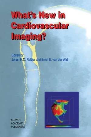 What’s New in Cardiovascular Imaging? de Johan H. C. Reiber