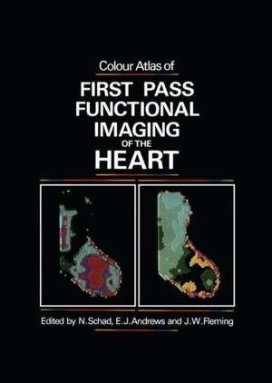 Colour Atlas of First Pass Functional Imaging of the Heart de N. Schad