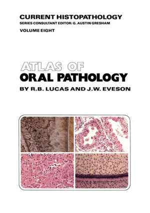 Atlas of Oral Pathology de R.B. Lucas