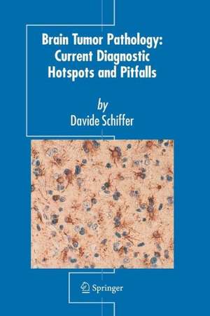 Brain Tumor Pathology: Current Diagnostic Hotspots and Pitfalls de Davide Schiffer