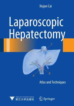 Laparoscopic Hepatectomy de Xiujun Cai