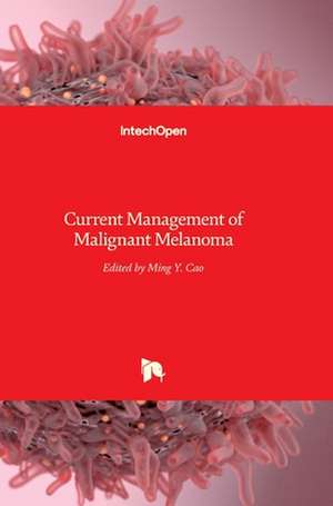 Current Management of Malignant Melanoma de Ming Yu Cao