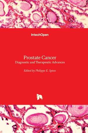 Prostate Cancer de Philippe E. Spiess