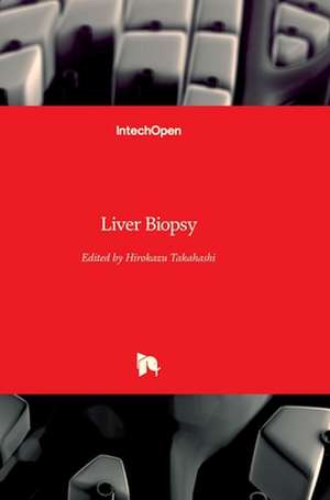 Liver Biopsy de Hirokazu Takahashi