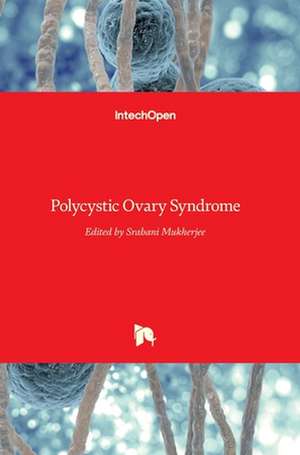 Polycystic Ovary Syndrome de Srabani Mukherjee