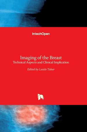 Imaging of the Breast de Laszlo Tabar