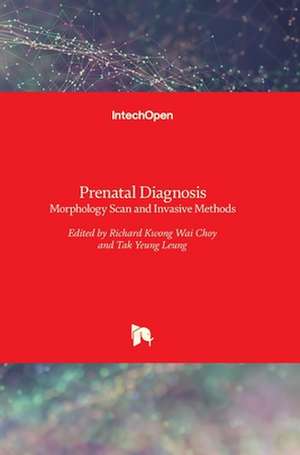 Prenatal Diagnosis de Richard Choy