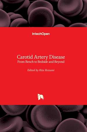 Carotid Artery Disease de Rita Rezzani